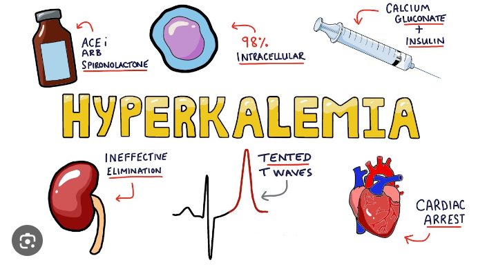 Hyperkalemia