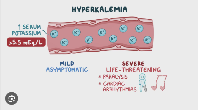 Hyperkalemia