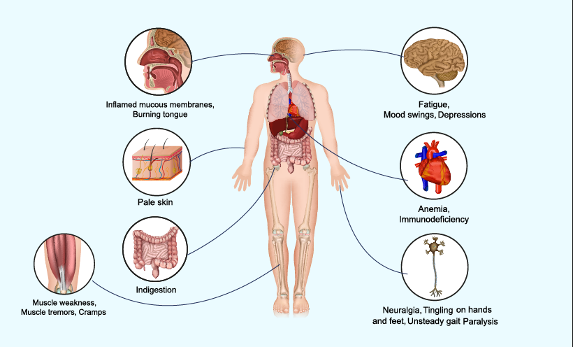 Vitamin B12, Paralysis