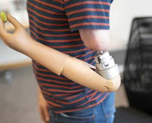 New Prosthetic Hand