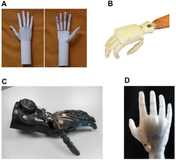 New Prosthetic Hand