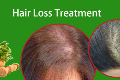 Hair Loss Treatment