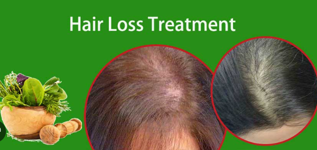 Hair Loss Treatment