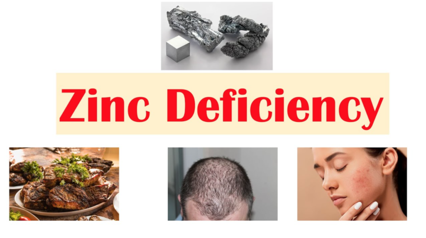 Zinc Deficiency