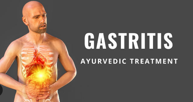 Gastritis Treatment