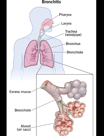 Antibiotics