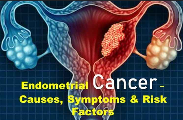 endometrial cancer,