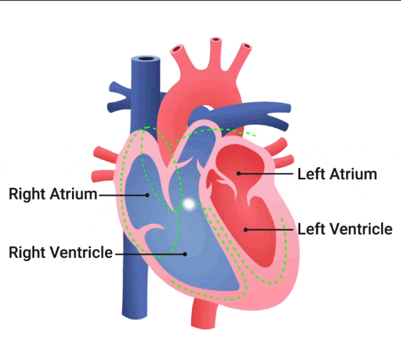 Heart Arrhythmias